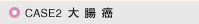 CASE2 咰
