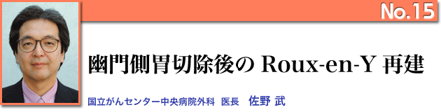 幽門胃切除のRoux-en-Y再建